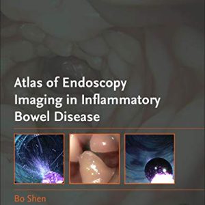 Atlas of Endoscopy Imaging in Inflammatory Bowel Disease (Original PDF from Publisher)