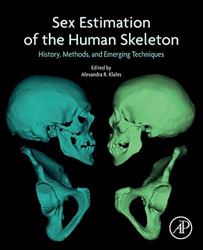Sex Estimation of the Human Skeleton: History, Methods, and Emerging Techniques (Original PDF from Publisher)