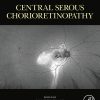 Central Serous Chorioretinopathy (Original PDF from Publisher)