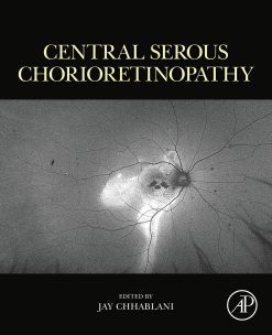Central Serous Chorioretinopathy (Original PDF from Publisher)