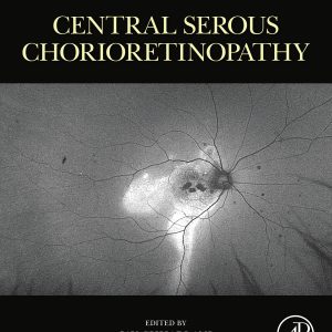 Central Serous Chorioretinopathy (Original PDF from Publisher)