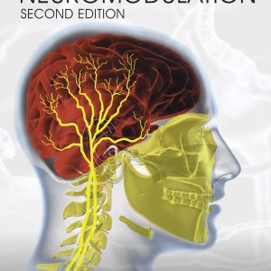 Essential Neuromodulation, 2nd Edition (EPUB)
