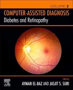 Diabetes and Retinopathy  (Original PDF from Publisher)