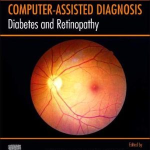 Diabetes and Retinopathy (Original PDF from Publisher)