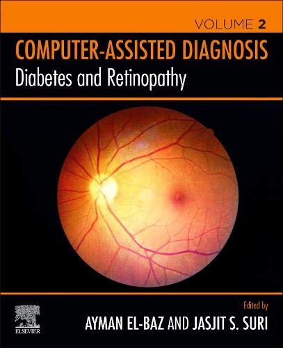 Diabetes and Retinopathy (Original PDF from Publisher)