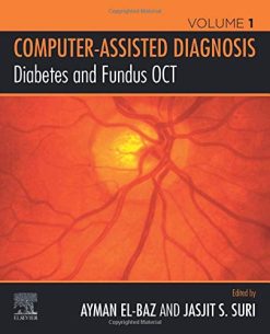 Diabetes and Fundus OCT (Computer-assisted Diagnosis, Volume 1) (Original PDF from Publisher)