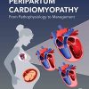 Peripartum Cardiomyopathy: From Pathophysiology to Management (Original PDF from Publisher)