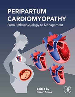 Peripartum Cardiomyopathy: From Pathophysiology to Management (Original PDF from Publisher)