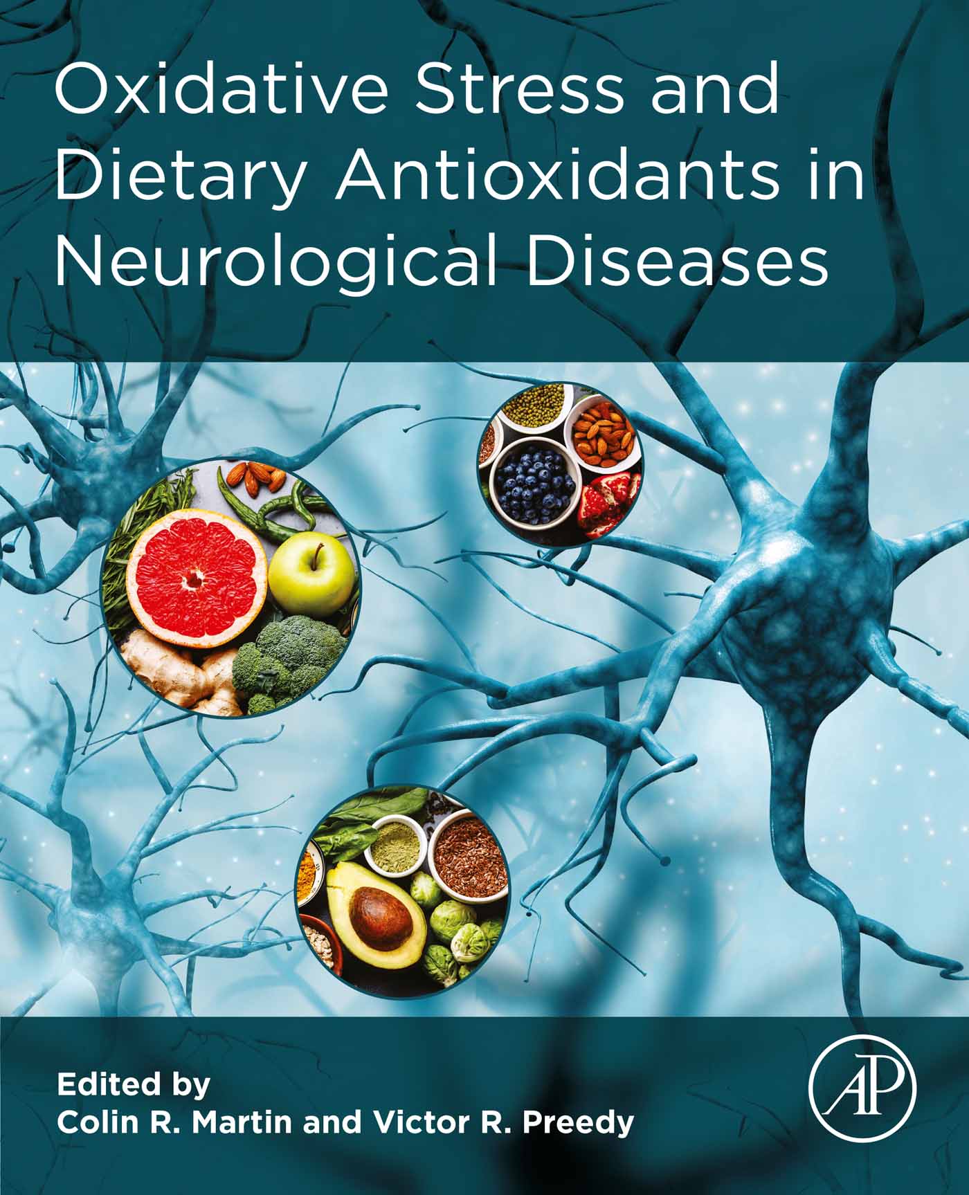 Oxidative Stress and Dietary Antioxidants in Neurological Diseases (EPUB)