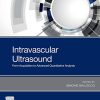 Intravascular Ultrasound: From Acquisition to Advanced Quantitative Analysis (Original PDF from Publisher)