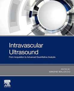 Intravascular Ultrasound: From Acquisition to Advanced Quantitative Analysis (Original PDF from Publisher)