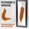 Peyronie’s Disease: Pathophysiology and Treatment (Original PDF from Publisher)