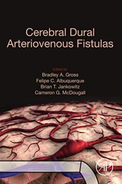 Cerebral Dural Arteriovenous Fistulas (Original PDF from Publisher)