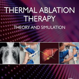 Thermal Ablation Therapy: Theory and Simulation (EPUB)