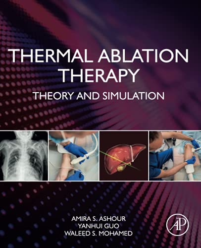 Thermal Ablation Therapy: Theory and Simulation (Original PDF from Publisher)