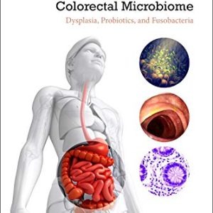 Colorectal Neoplasia and the Colorectal Microbiome: Dysplasia, Probiotics, and Fusobacteria (Original PDF from Publisher)