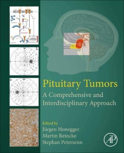 Pituitary Tumors: A Comprehensive and Interdisciplinary Approach (Original PDF from Publisher)