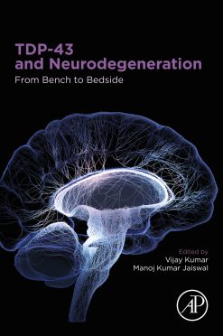 TDP-43 and Neurodegeneration: From Bench to Bedside (EPUB)