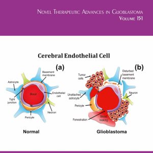 Novel Therapeutic Advances in Glioblastoma (Volume 151) (International Review of Neurobiology (Volume 151) (EPUB)