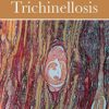 Trichinella and Trichinellosis (Original PDF from Publisher)