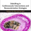 Debulking in Cardiovascular Interventions and Revascularization Strategies: Between a Rock and the Heart (Original PDF from Publisher)