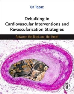 Debulking in Cardiovascular Interventions and Revascularization Strategies: Between a Rock and the Heart (Original PDF from Publisher)