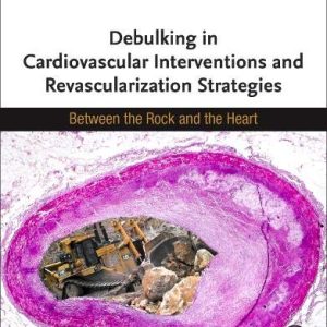 Debulking in Cardiovascular Interventions and Revascularization Strategies: Between a Rock and the Heart (Original PDF from Publisher)