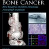 Bone Cancer: Bone Sarcomas and Bone Metastases – From Bench to Bedside, 3rd Edition (Original PDF from Publisher)