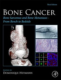 Bone Cancer: Bone Sarcomas and Bone Metastases – From Bench to Bedside, 3rd Edition (Original PDF from Publisher)