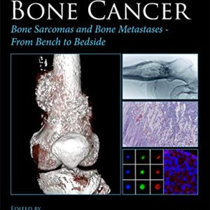 Bone Cancer: Bone Sarcomas and Bone Metastases – From Bench to Bedside, 3rd Edition (Original PDF from Publisher)