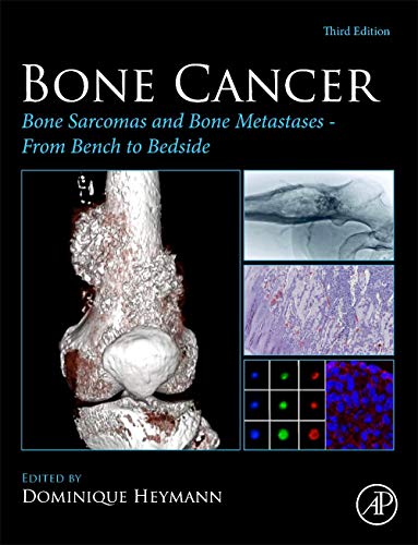 Bone Cancer: Bone Sarcomas and Bone Metastases – From Bench to Bedside, 3rd Edition (Original PDF from Publisher)