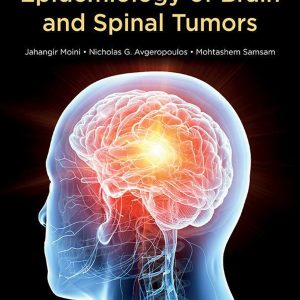 Epidemiology of Brain and Spinal Tumors (EPUB)