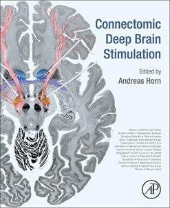Connectomic Deep Brain Stimulation (Original PDF from Publisher)