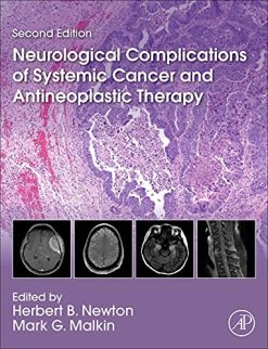 Neurological Complications of Systemic Cancer and Antineoplastic Therapy, 2nd Edition (Original PDF from Publisher)