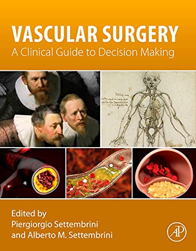 Vascular Surgery: A Clinical Guide to Decision-making (Original PDF from Publisher)
