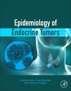 Epidemiology of Endocrine Tumors (Original PDF from Publisher)