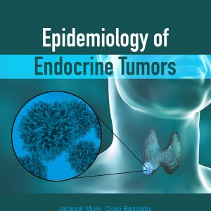 Epidemiology of Endocrine Tumors (EPUB)