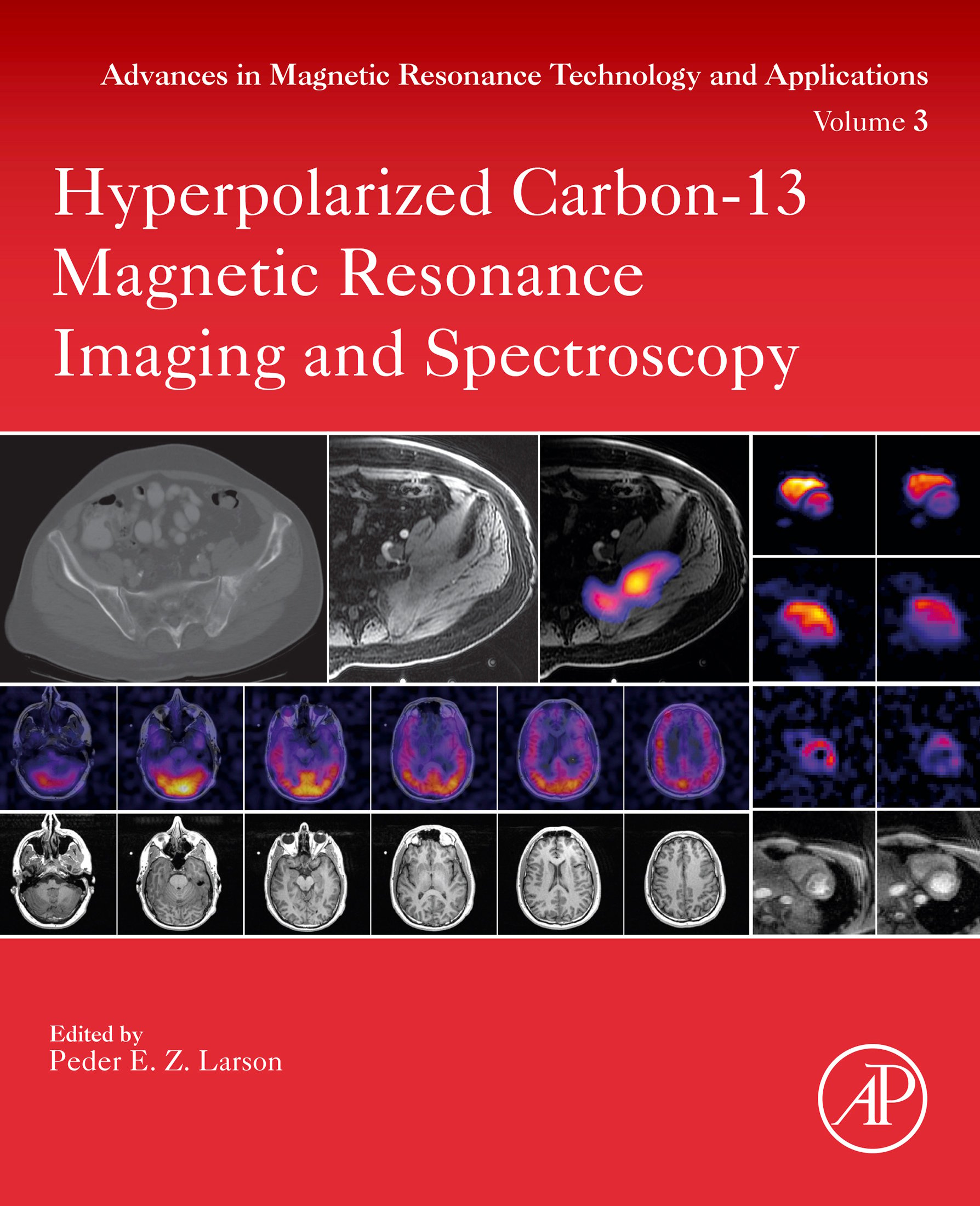 Hyperpolarized Carbon-13 Magnetic Resonance Imaging and Spectroscopy (Original PDF from Publisher)