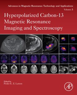 Hyperpolarized Carbon-13 Magnetic Resonance Imaging and Spectroscopy (EPUB)
