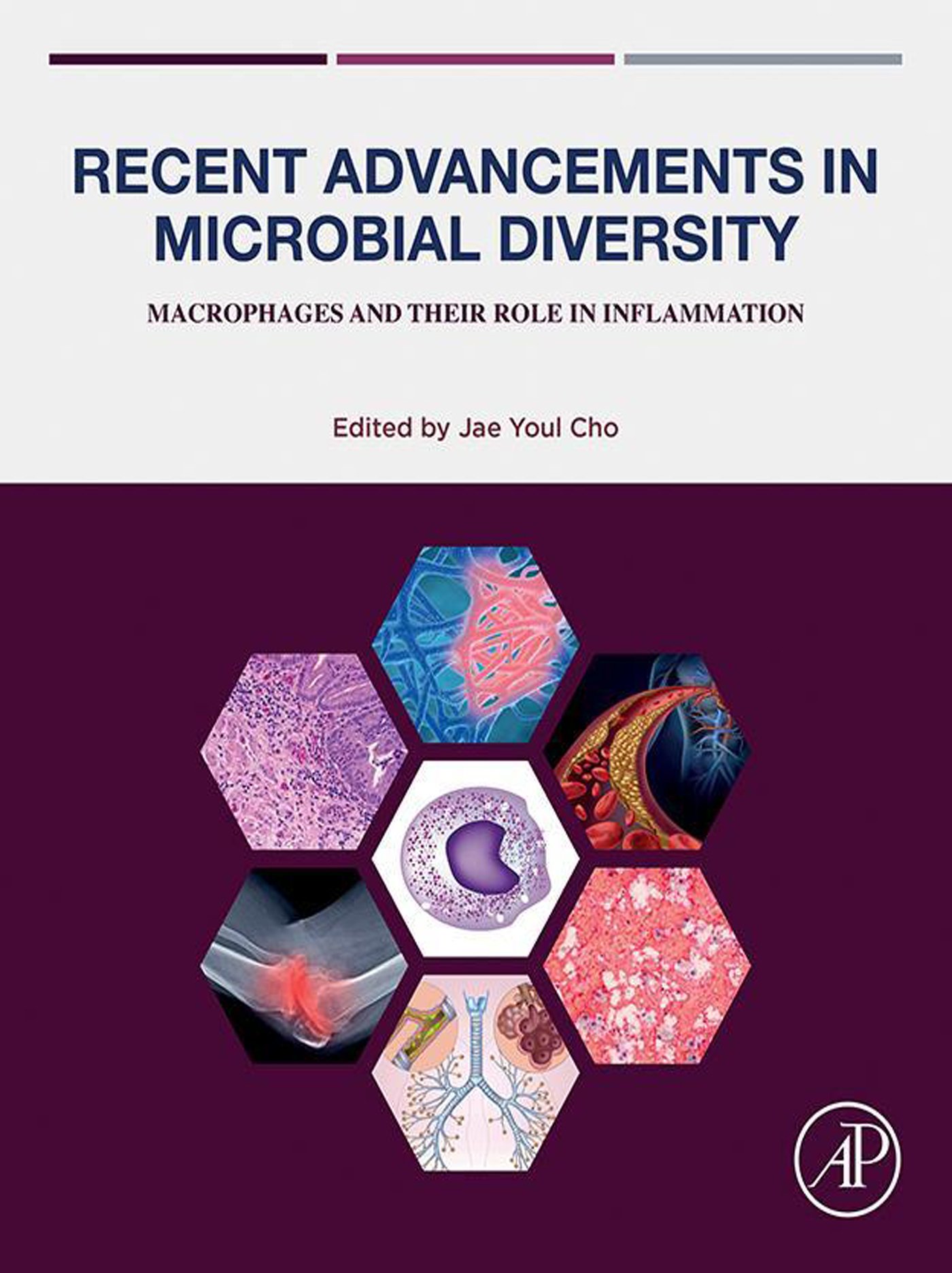 Recent Advancements in Microbial Diversity: Macrophages and their Role in Inflammation (Original PDF from Publisher)
