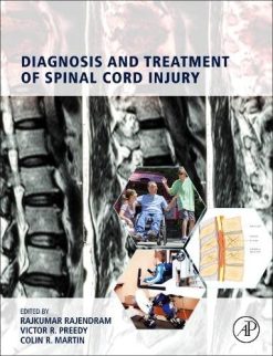 Diagnosis and Treatment of Spinal Cord Injury (Original PDF from Publisher)