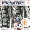 Diagnosis and Treatment of Spinal Cord Injury (EPUB)