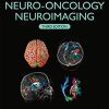 Handbook of Neuro-Oncology Neuroimaging, 3rd Edition (Original PDF from Publisher)