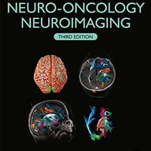 Handbook of Neuro-Oncology Neuroimaging, 3rd Edition (Original PDF from Publisher)