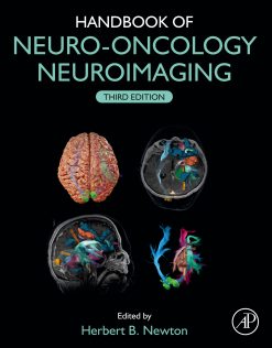 Handbook of Neuro-Oncology Neuroimaging, 3rd Edition (EPUB)