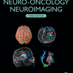Handbook of Neuro-Oncology Neuroimaging, 3rd Edition (EPUB)