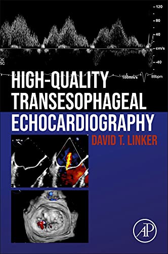 High-Quality Transesophageal Echocardiography (Original PDF from Publisher)