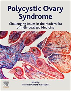 Polycystic Ovary Syndrome: Challenging Issues in the Modern Era of Individualized Medicine (Original PDF from Publisher)