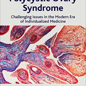 Polycystic Ovary Syndrome: Challenging Issues in the Modern Era of Individualized Medicine (Original PDF from Publisher)