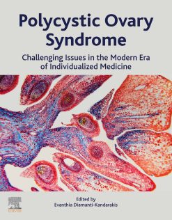 Polycystic Ovary Syndrome: Challenging Issues in the Modern Era of Individualized Medicine (EPUB)